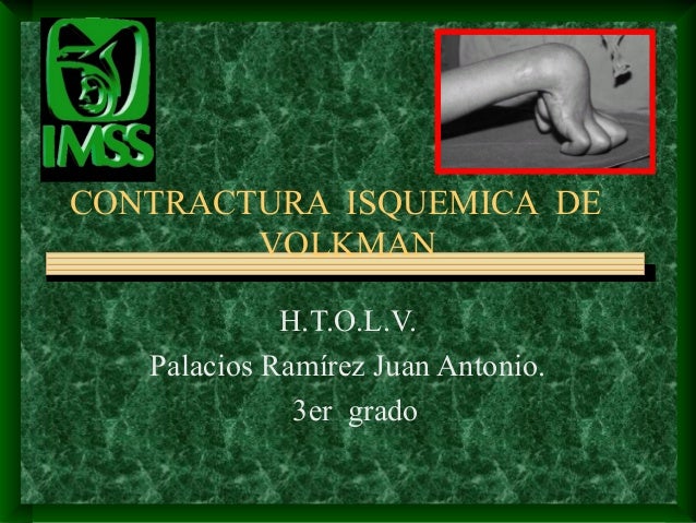 contractura de volkman